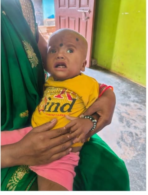 Chirayu Yojana also proved to be a lifeline for children: Three children underwent successful free surgeries in Raipur.