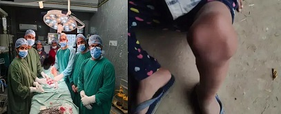 5-year-old boy successfully operated on for rare knee disease at SIMS Hospital